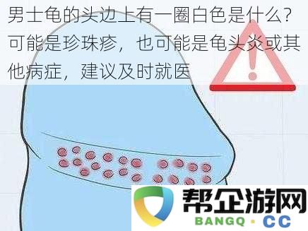 男士龟的头边上有一圈白色是什么？可能是珍珠疹，也可能是龟头炎或其他病症，建议及时就医